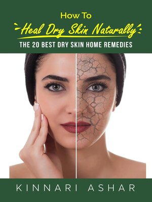 cover image of How to Heal Dry Skin Naturally